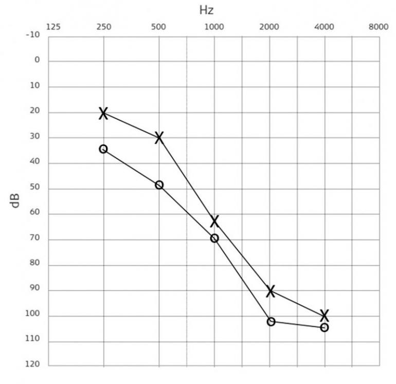 Technické kukátko - Lidský sluch a audiogram